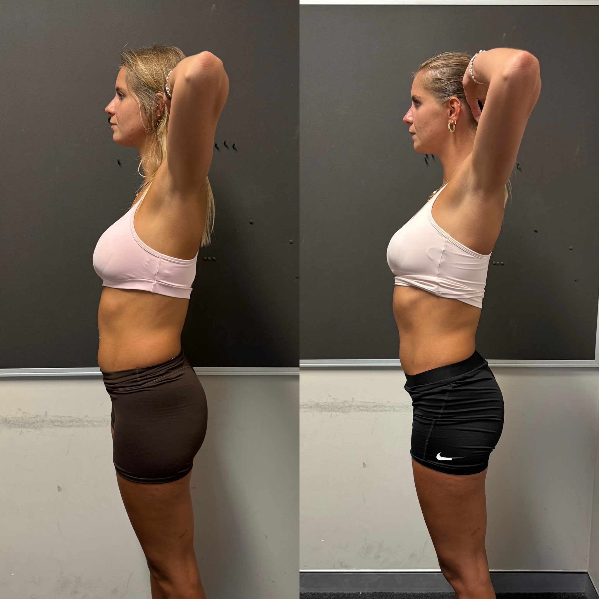 Chantal before and after side transformation
