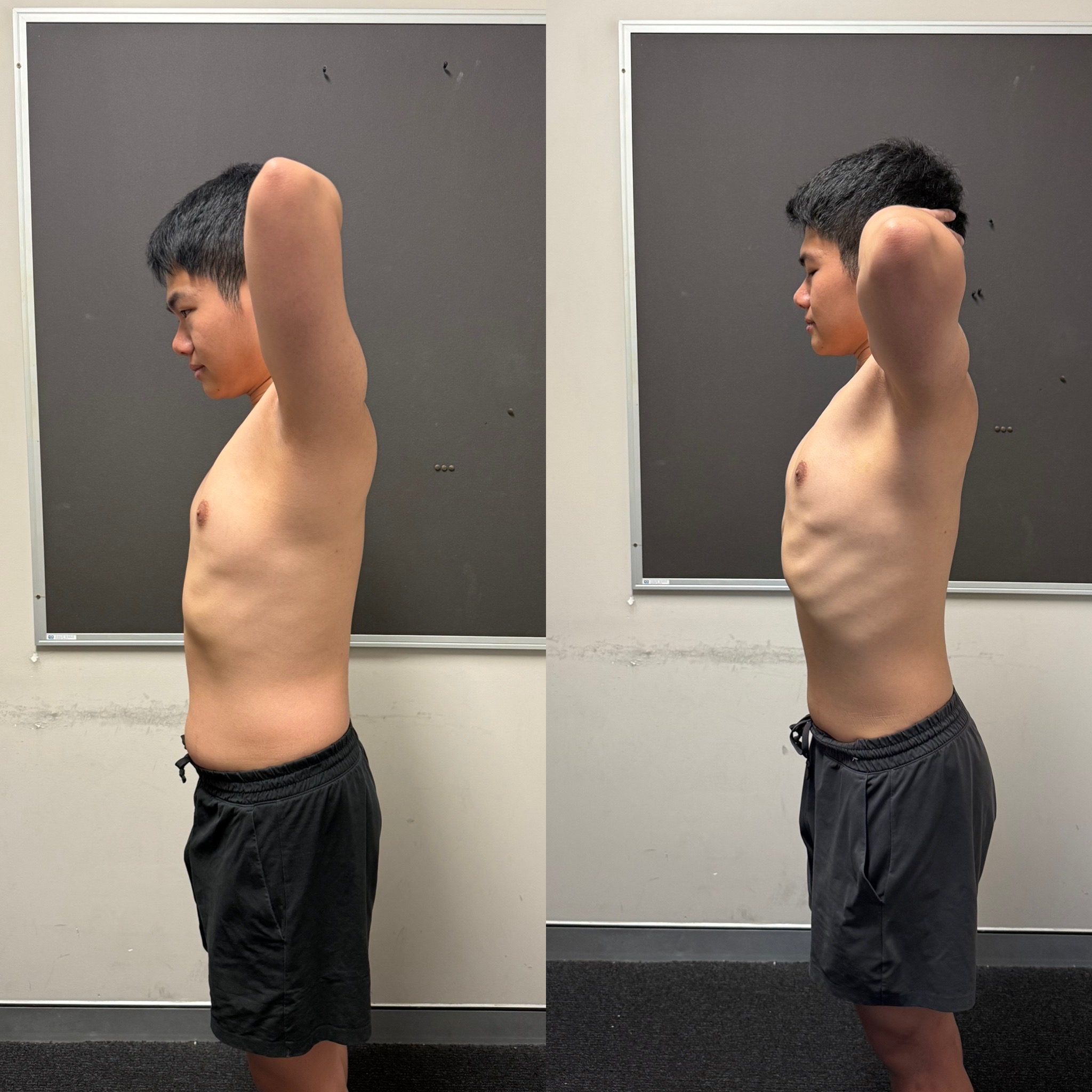 Chris before and after side transformation