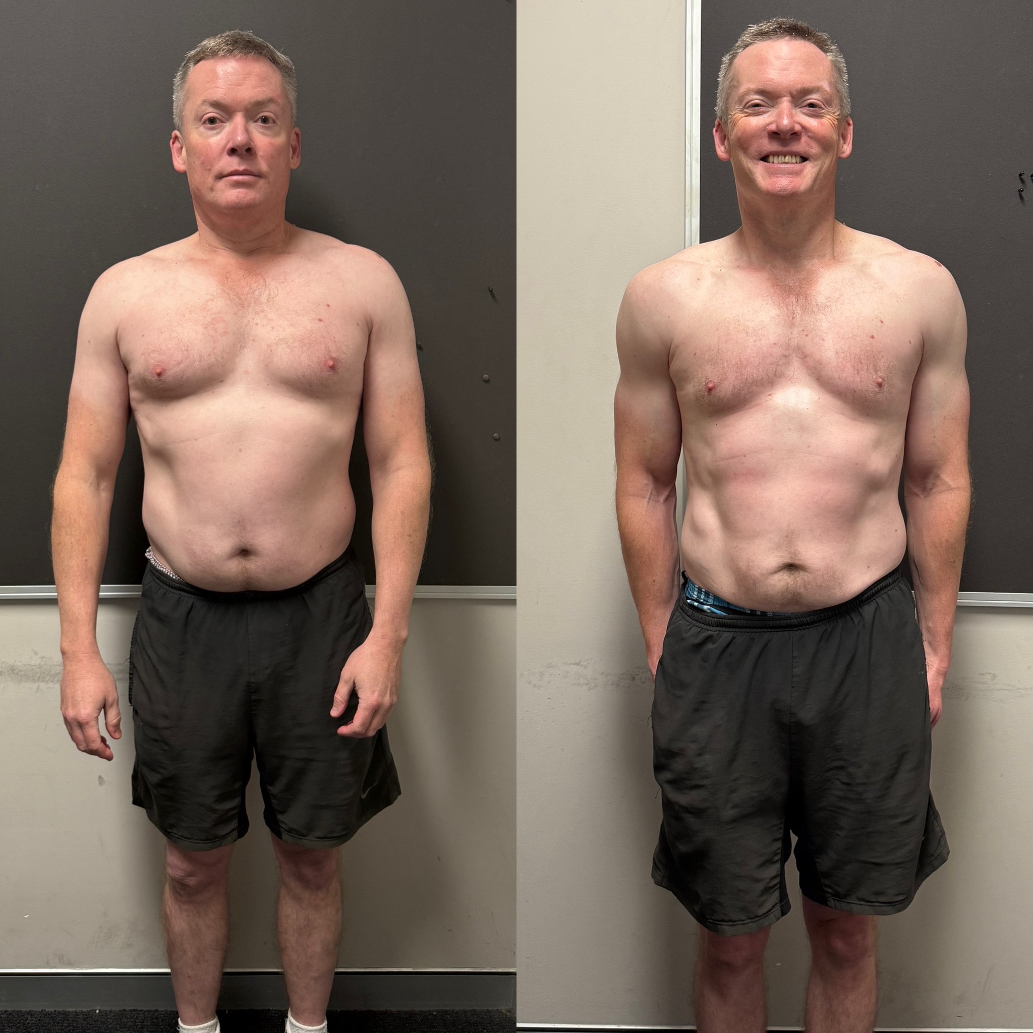 Feargus before and after front transformation